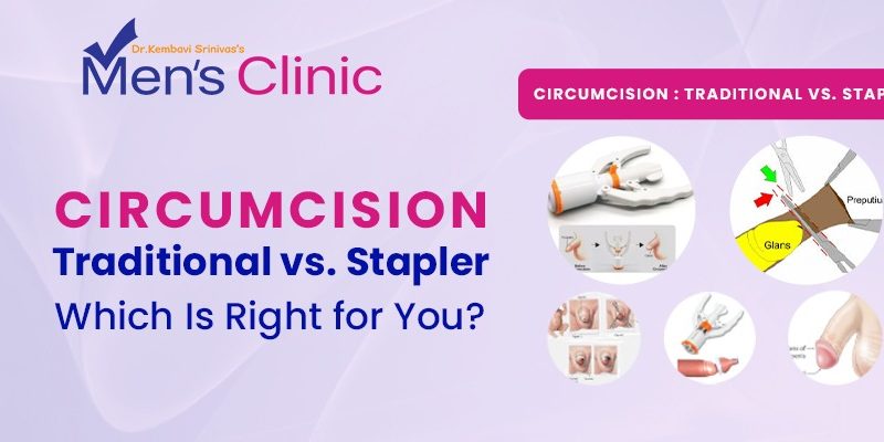 Best Hospital for Circumcision surgery in Hyderabad